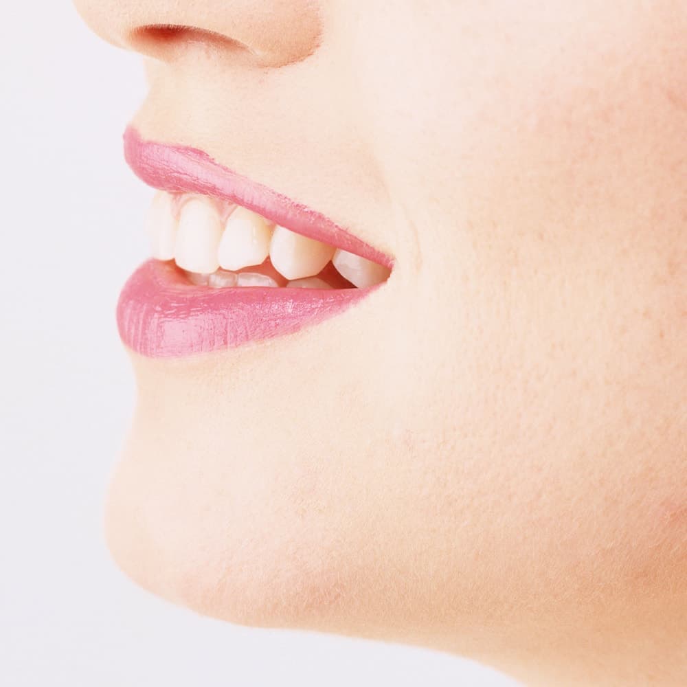 歯科ホワイトニング